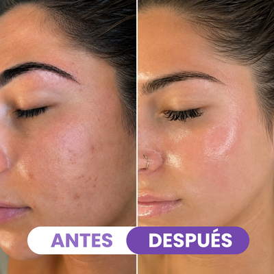 Mascarilla Facial de Hidrogel
