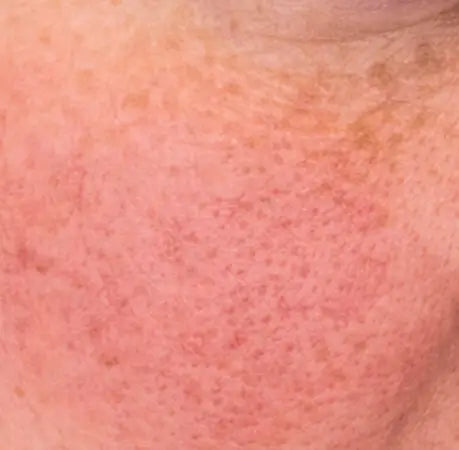 Rojeces